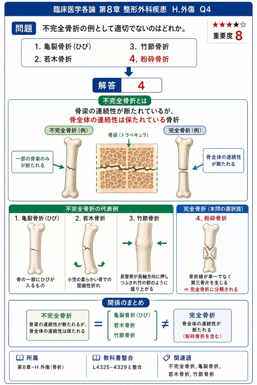 不完全骨折の例として適切でないのはどれか。 解説図