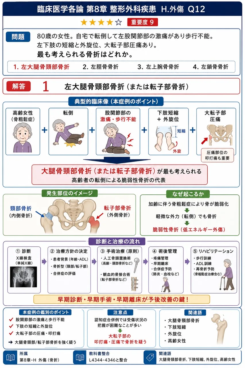 「80歳の女性。自宅で転倒して左股関節部の激痛があり歩行不能。左下肢の短縮と外旋位、大転子部圧痛あり。」最も考えられる骨折はどれか。 解説図