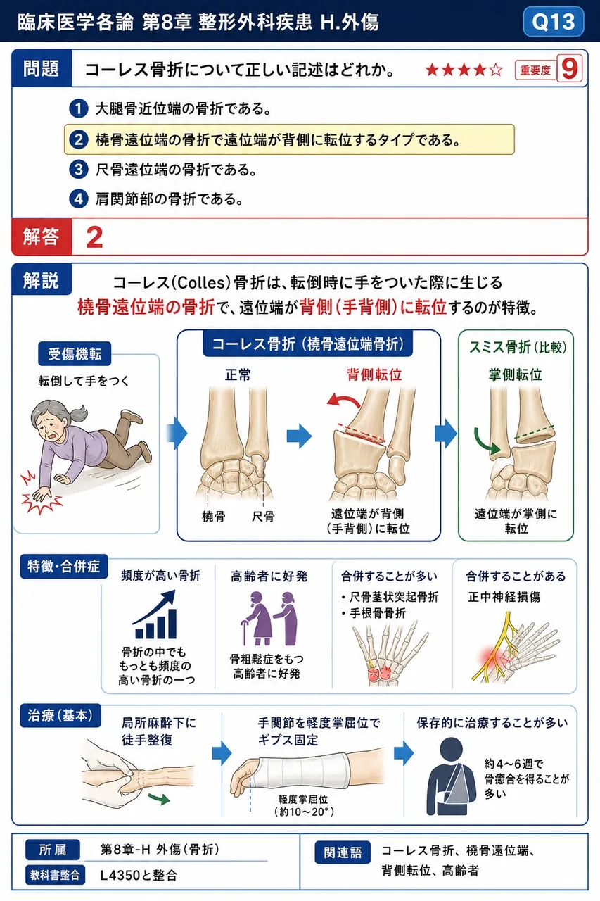 コーレス骨折について正しい記述はどれか。 解説図