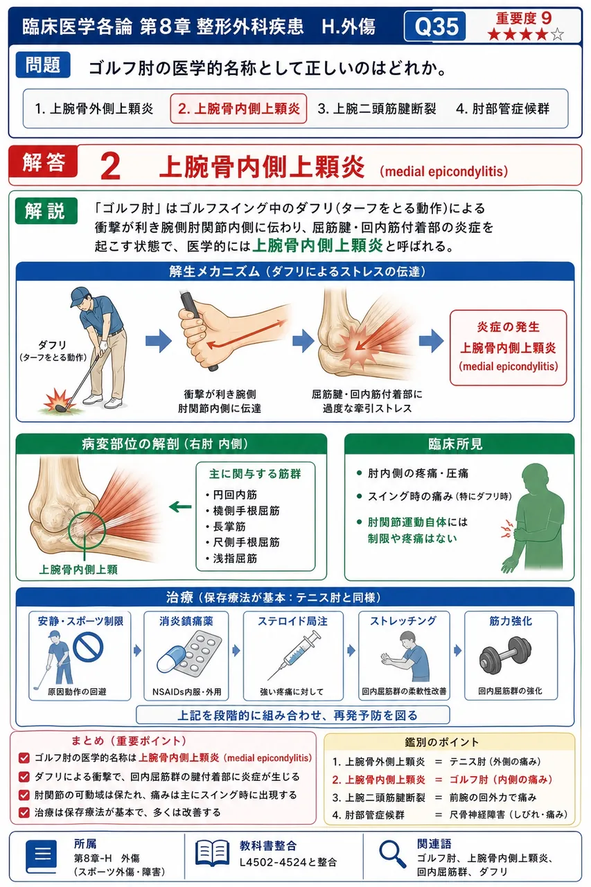 ゴルフ肘の医学的名称として正しいのはどれか。 解説図