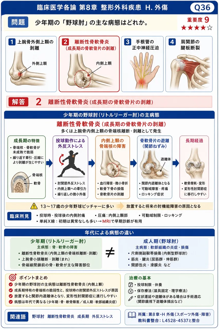 少年期の「野球肘」の主な病態はどれか。 解説図