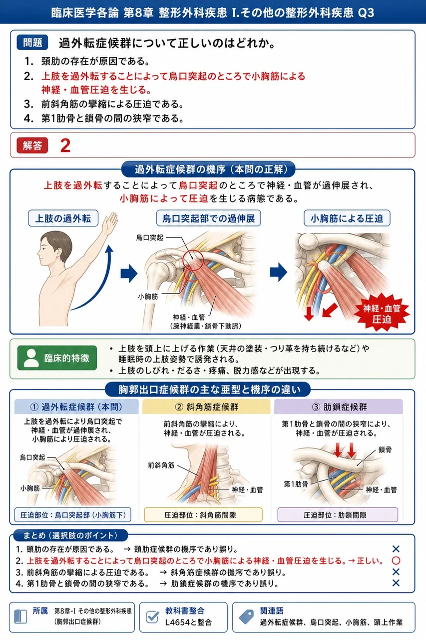 過外転症候群について正しいのはどれか。 解説図