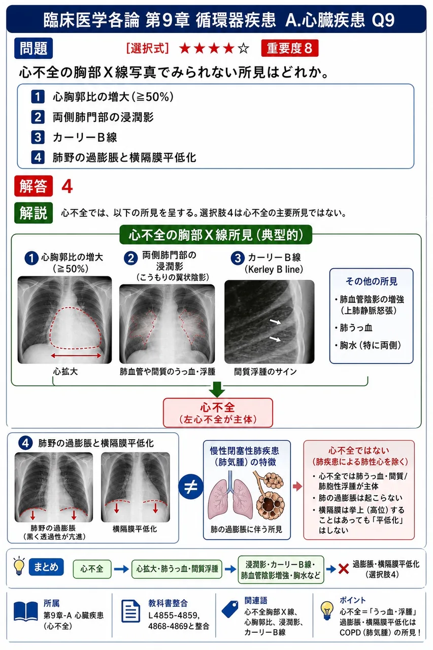 心不全の胸部X線写真でみられない所見はどれか。 解説図