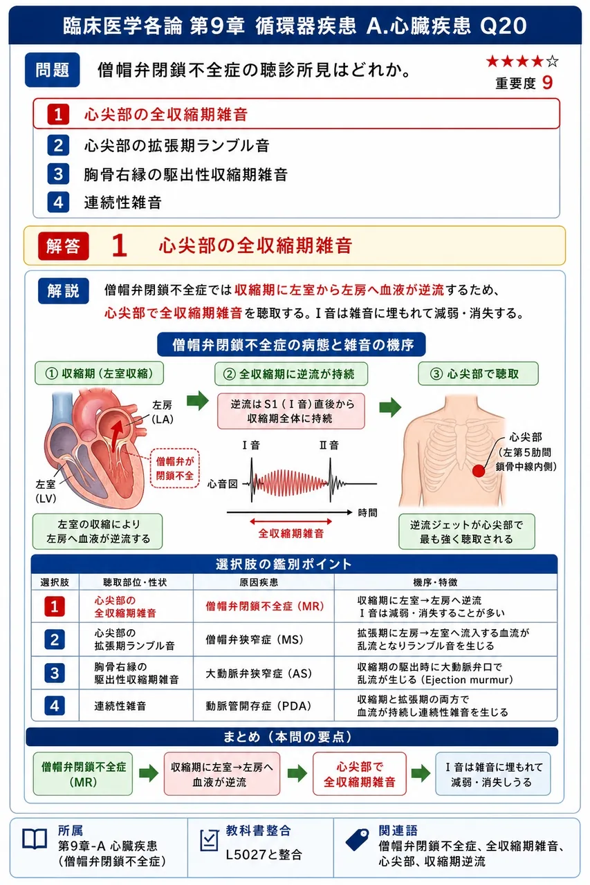 僧帽弁閉鎖不全症の聴診所見はどれか。 解説図