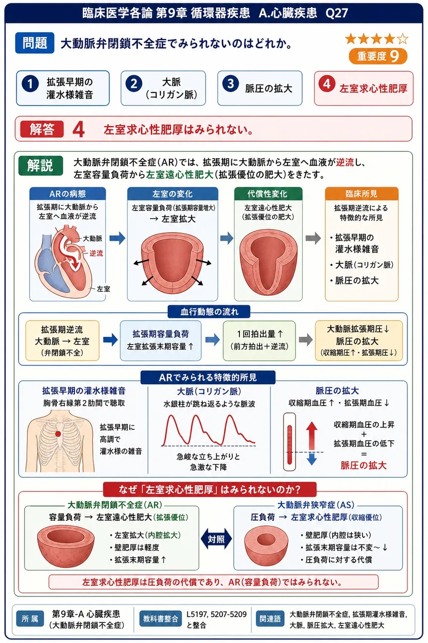 大動脈弁閉鎖不全症でみられないのはどれか。 解説図