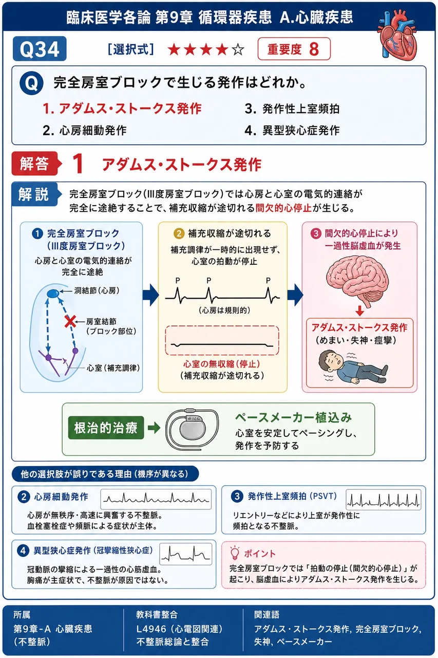 完全房室ブロックで生じる発作はどれか。 解説図