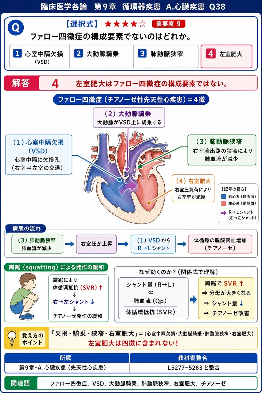 ファロー四徴症の構成要素でないのはどれか。 解説図