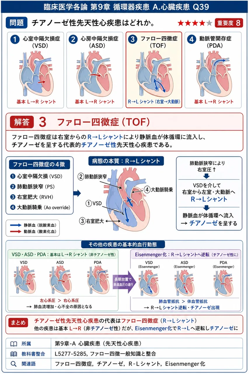 チアノーゼ性先天性心疾患はどれか。 解説図