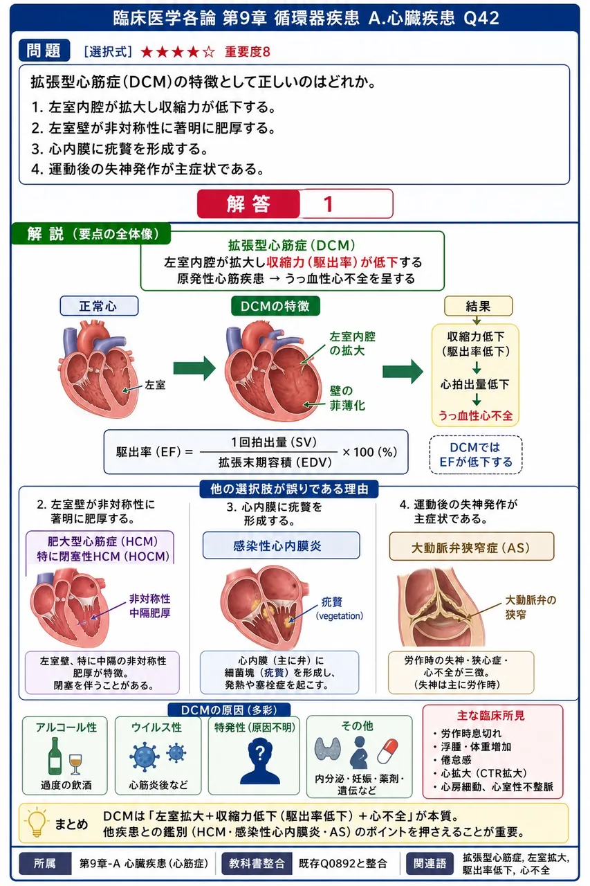 拡張型心筋症(DCM)の特徴として正しいのはどれか。 解説図