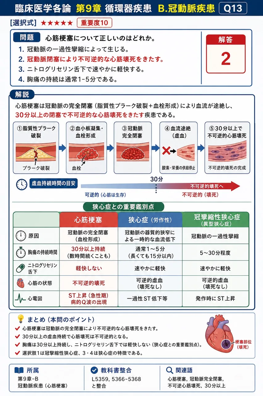 心筋梗塞について正しいのはどれか。 解説図