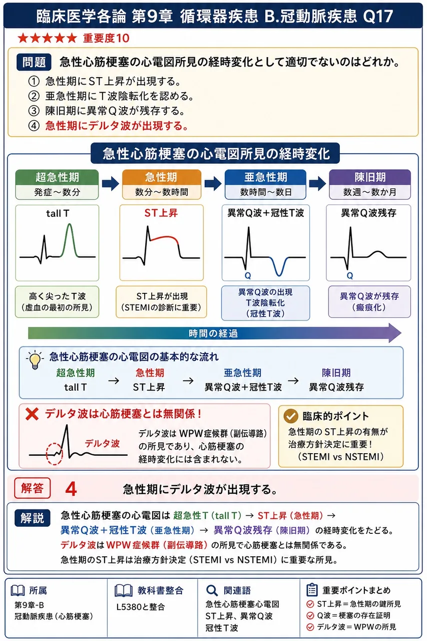 急性心筋梗塞の心電図所見の経時変化として適切でないのはどれか。 解説図