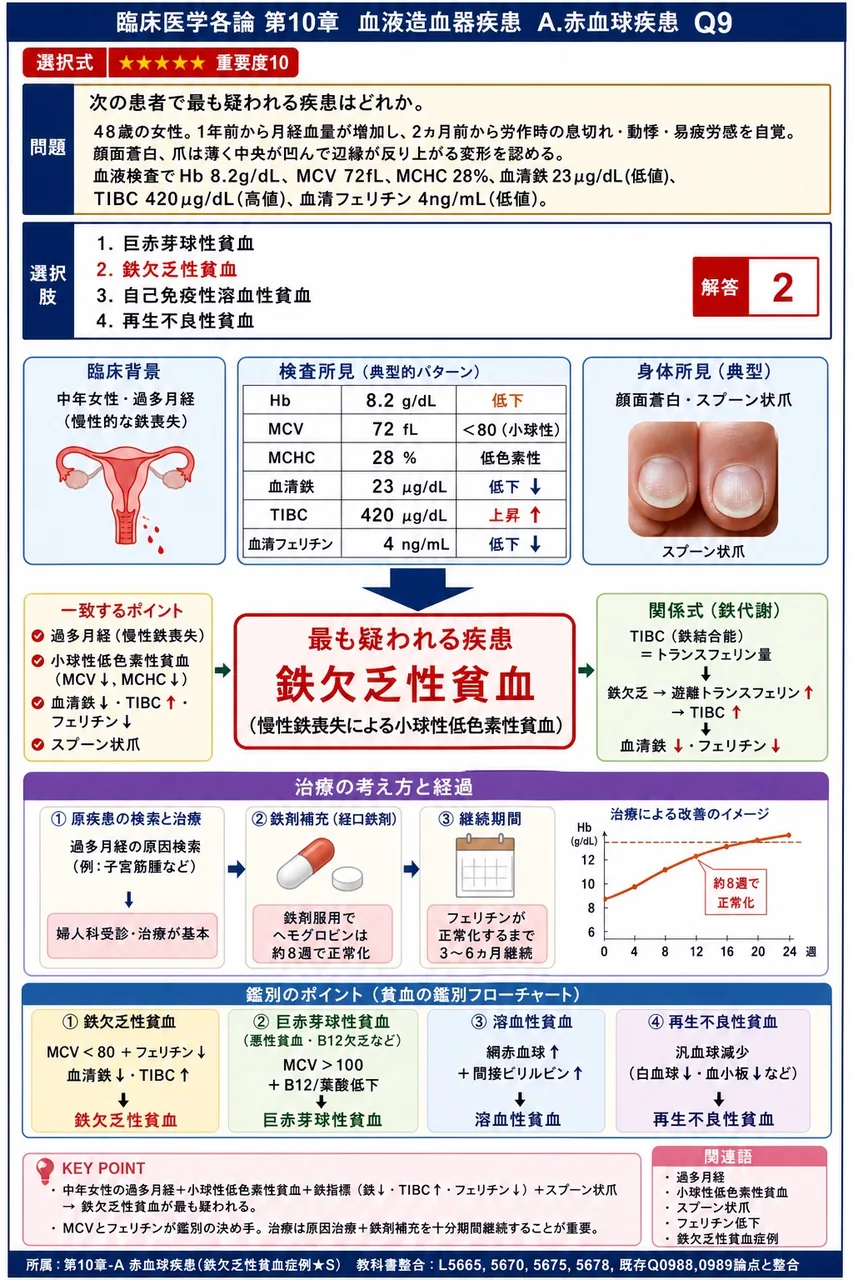 次の患者で最も疑われる疾患はどれか。 「48歳の女性。1年前から月経血量が増加し、2ヵ月前から労作時の息切れ・動悸・易疲労感を自覚。顔面蒼白、爪は薄く中央が凹んで辺縁が反り上がる変形を認める。血液検査でHb 8.2g/dL、MCV 72fL、MCHC 28%、血清鉄23μg/dL(低値)、TIBC 420μg/dL(高値)、血清フェリチン4ng/mL(低値)。」 解説図