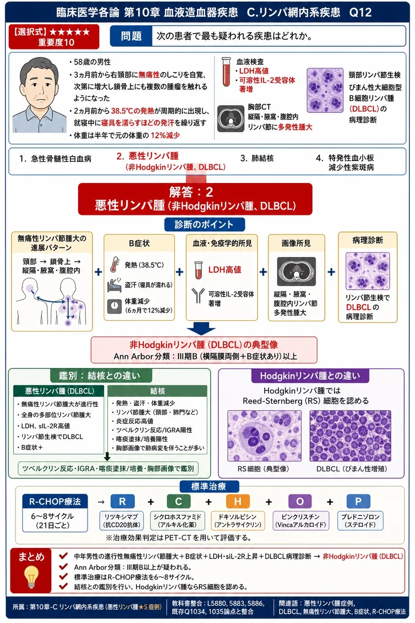 次の患者で最も疑われる疾患はどれか。 「58歳の男性。3ヵ月前から右頸部に無痛性のしこりを自覚、次第に増大し鎖骨上にも複数の腫瘤を触れるようになった。2ヵ月前から38.5°Cの発熱が周期的に出現し、就寝中に寝具を濡らすほどの発汗を繰り返している。体重は半年で元の体重の12%減少。血液検査で血清LDH高値、可溶性IL-2受容体著増。胸部CTで縦隔・腋窩・腹腔内リンパ節に多発性腫大を認める。頸部リンパ節生検でびまん性大細胞型B細胞リンパ腫(DLBCL)の病理診断。」 解説図