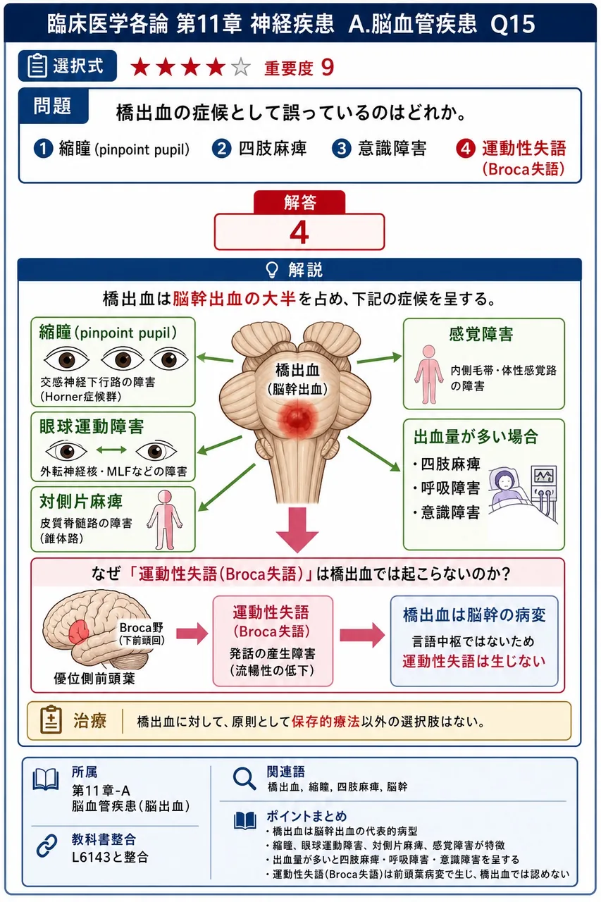 橋出血の症候として誤っているのはどれか。 解説図