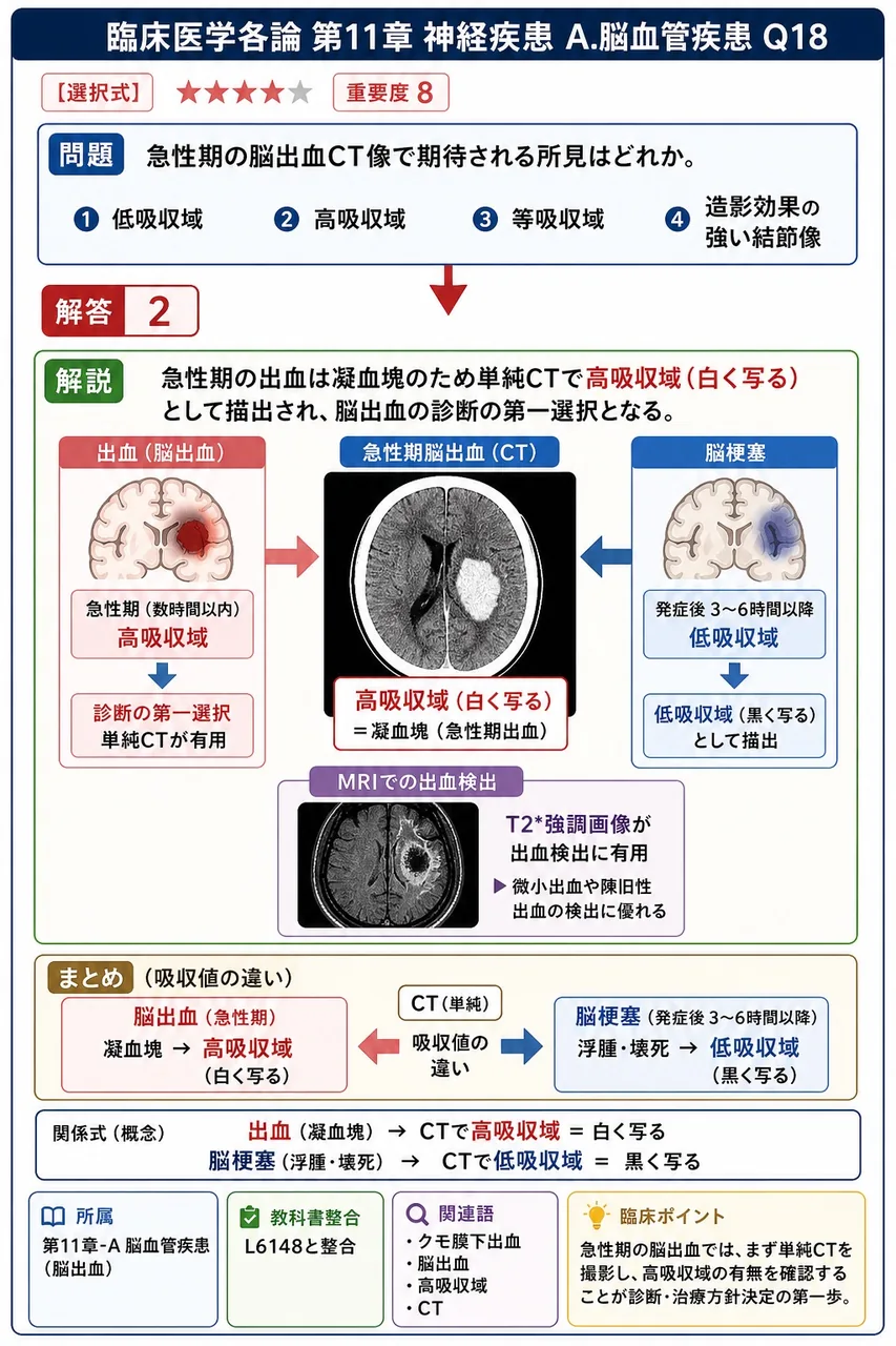 急性期の脳出血CT像で期待される所見はどれか。 解説図