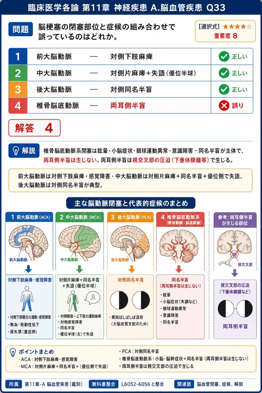 脳梗塞の閉塞部位と症候の組み合わせで誤っているのはどれか。 解説図