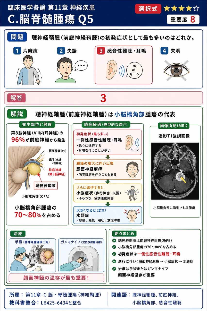 聴神経鞘腫(前庭神経鞘腫)の初発症状として最も多いのはどれか。 解説図