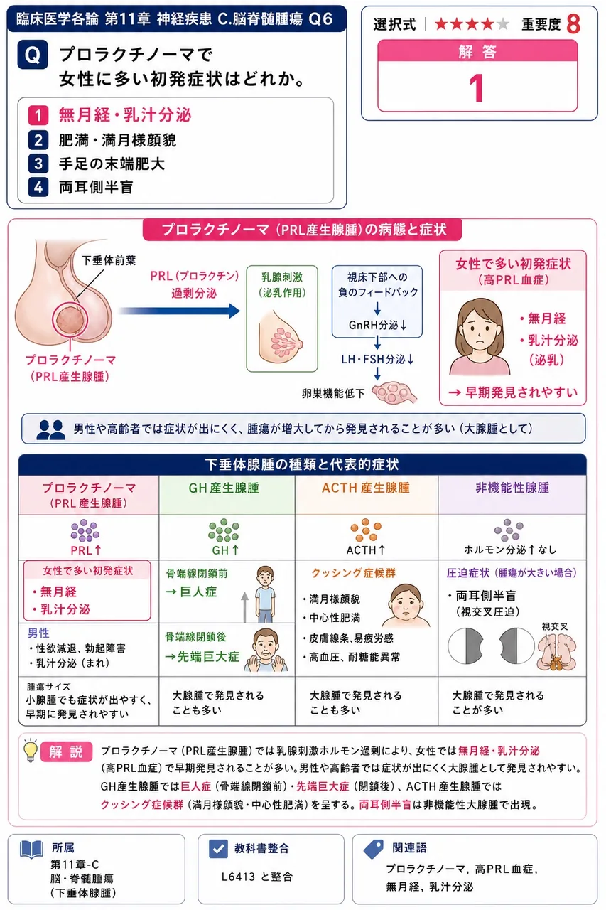 プロラクチノーマで女性に多い初発症状はどれか。 解説図