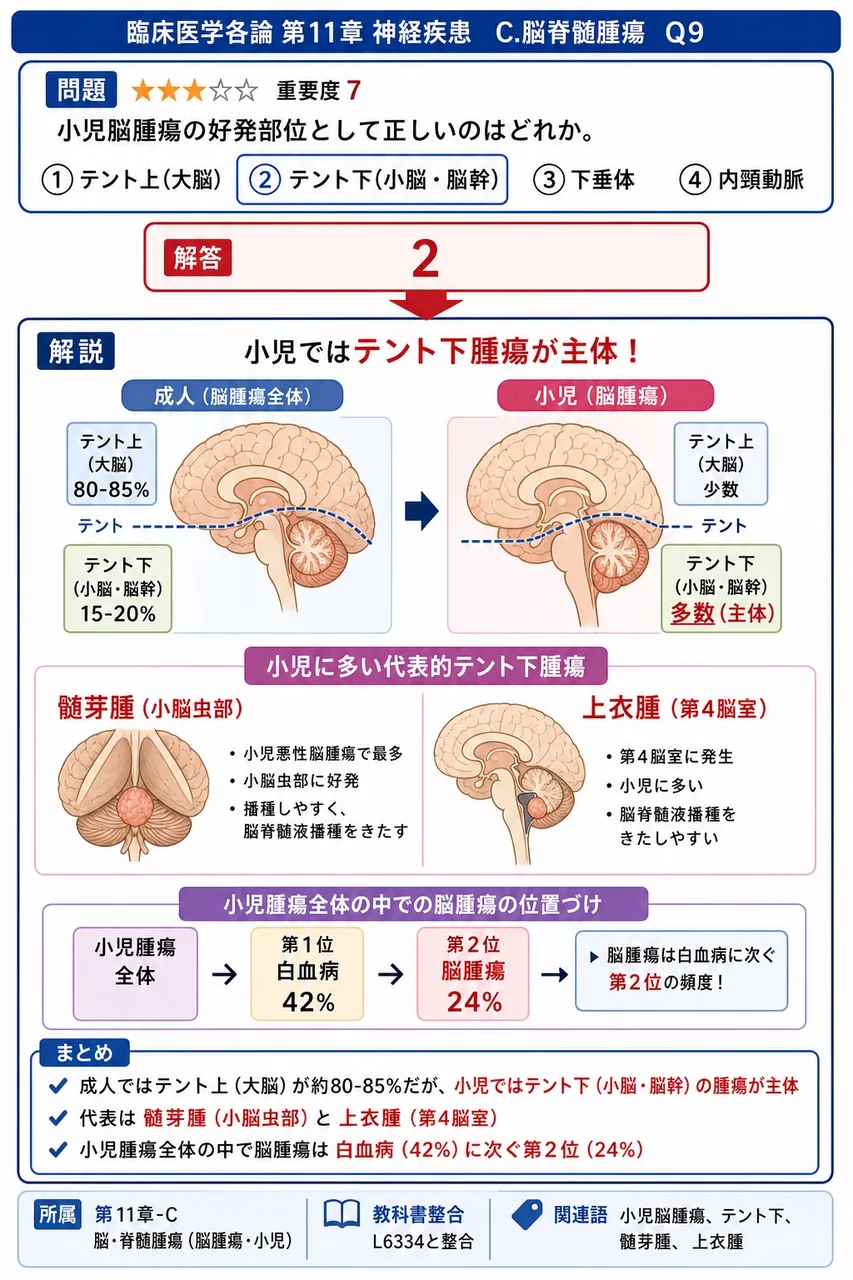 小児脳腫瘍の好発部位として正しいのはどれか。 解説図