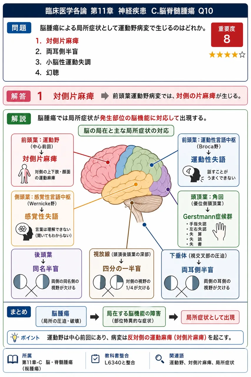 脳腫瘍による局所症状として運動野病変で生じるのはどれか。 解説図