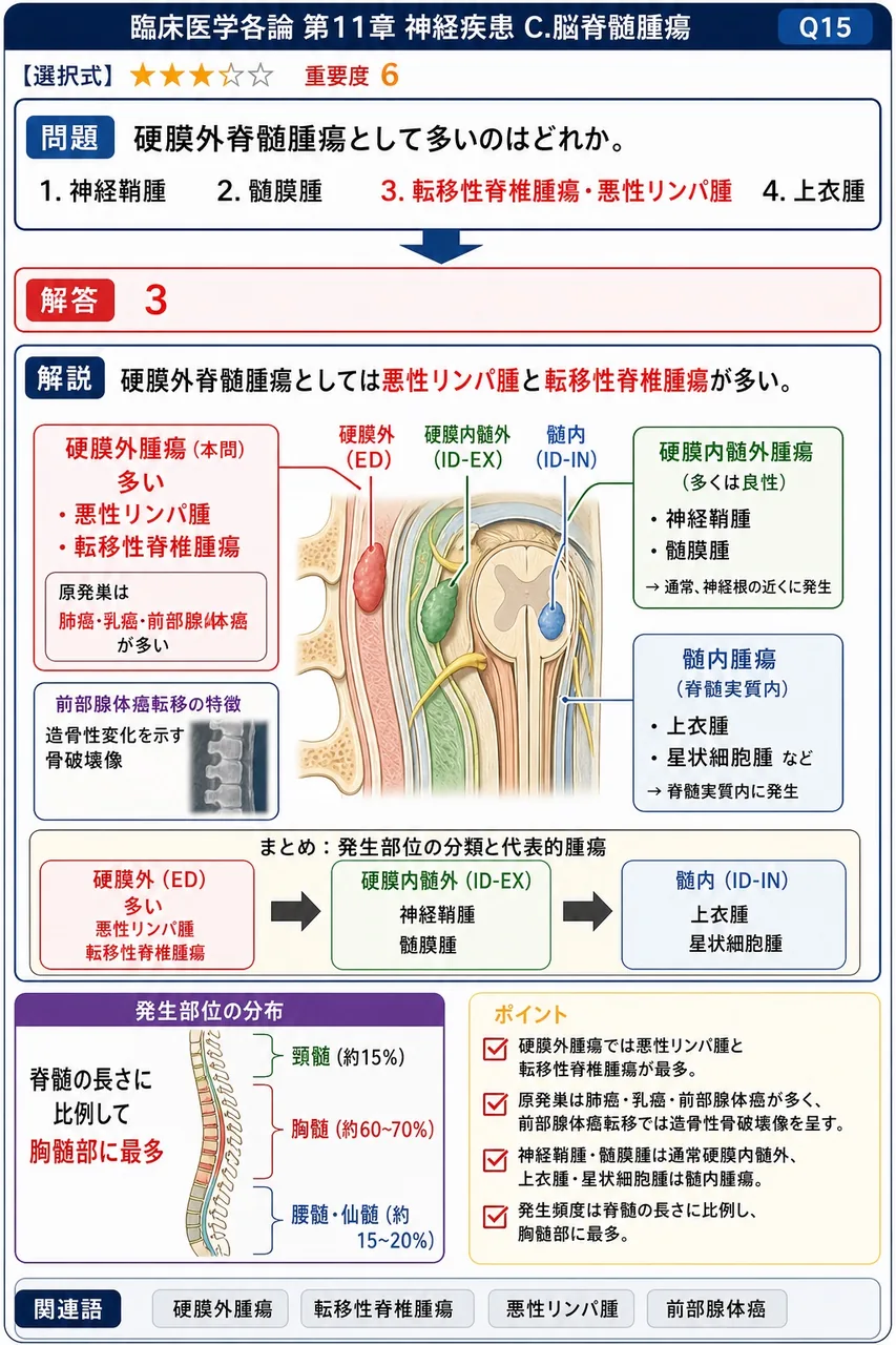 硬膜外脊髄腫瘍として多いのはどれか。 解説図
