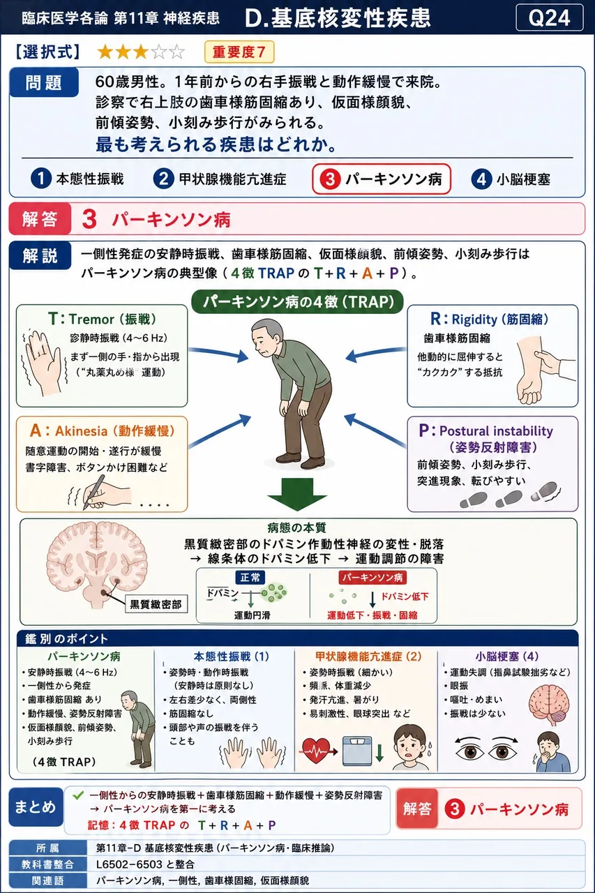 「60歳男性。1年前からの右手振戦と動作緩慢で来院。診察で右上肢の歯車様筋固縮あり、仮面様顔貌、前傾姿勢、小刻み歩行がみられる。」最も考えられる疾患はどれか。 解説図