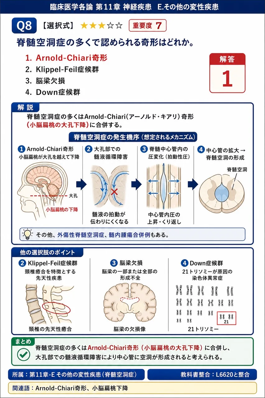 脊髄空洞症の多くで認められる奇形はどれか。 解説図