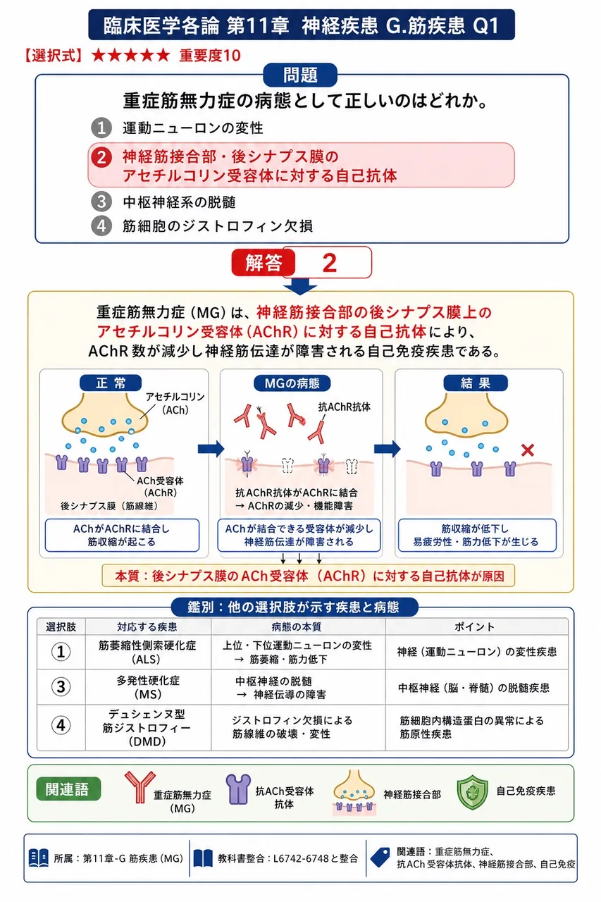重症筋無力症の病態として正しいのはどれか。 解説図