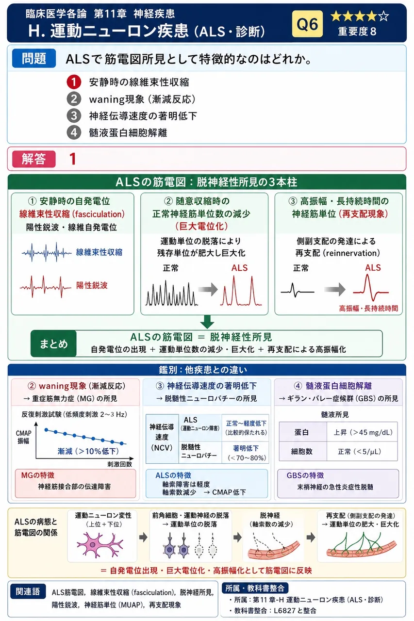 ALSで筋電図所見として特徴的なのはどれか。 解説図