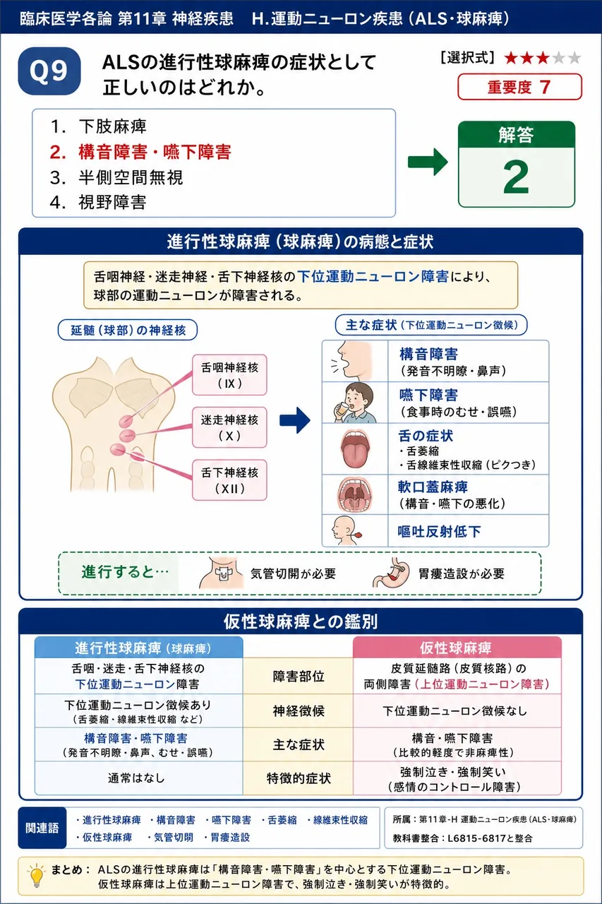 ALSの進行性球麻痺の症状として正しいのはどれか。 解説図