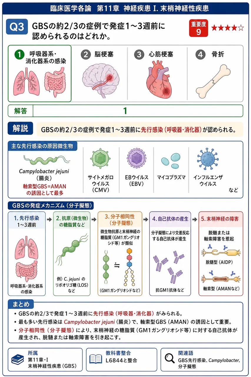 GBSの約2/3の症例で発症1〜3週前に認められるのはどれか。 解説図