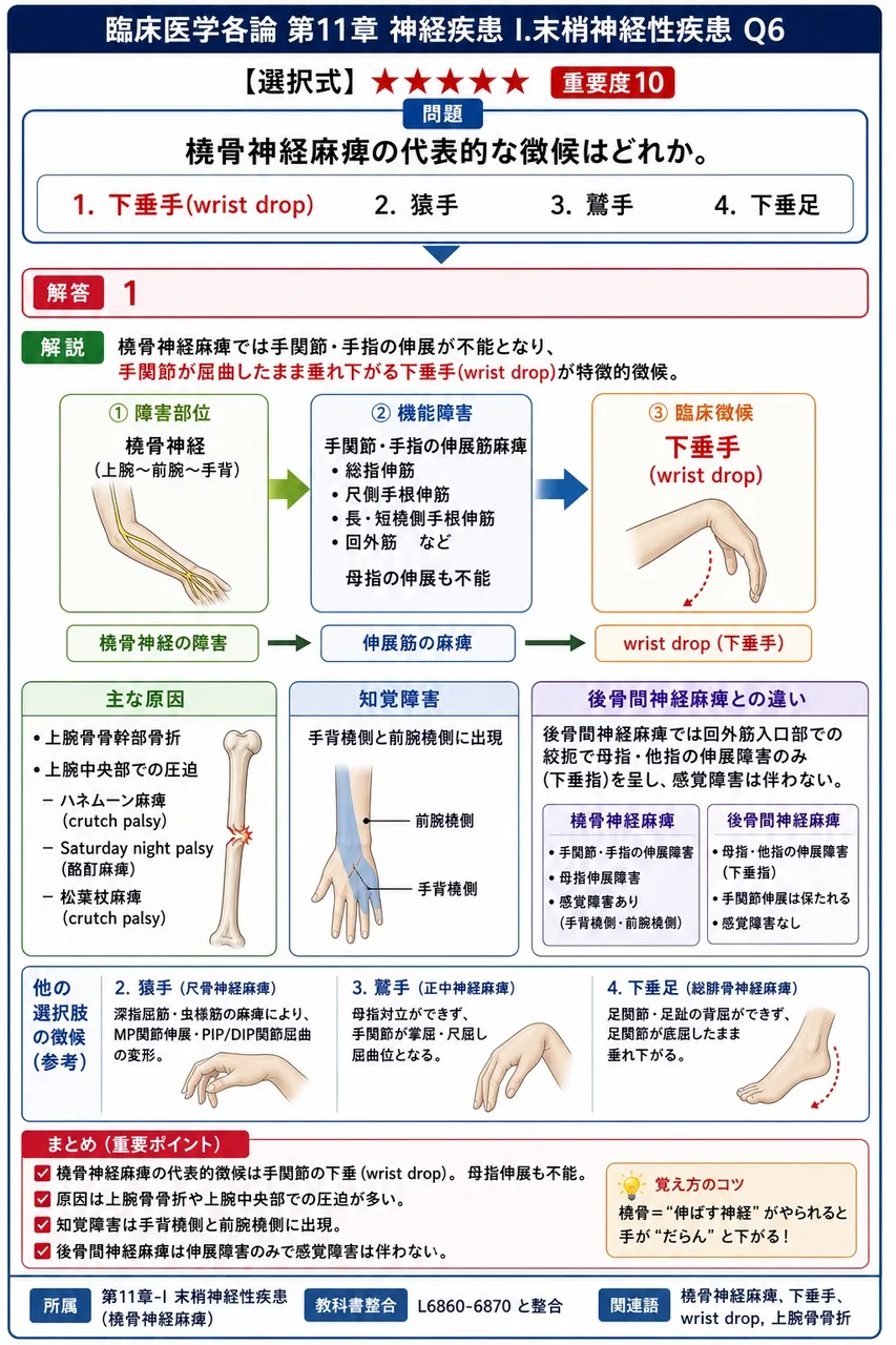 橈骨神経麻痺の代表的な徴候はどれか。 解説図