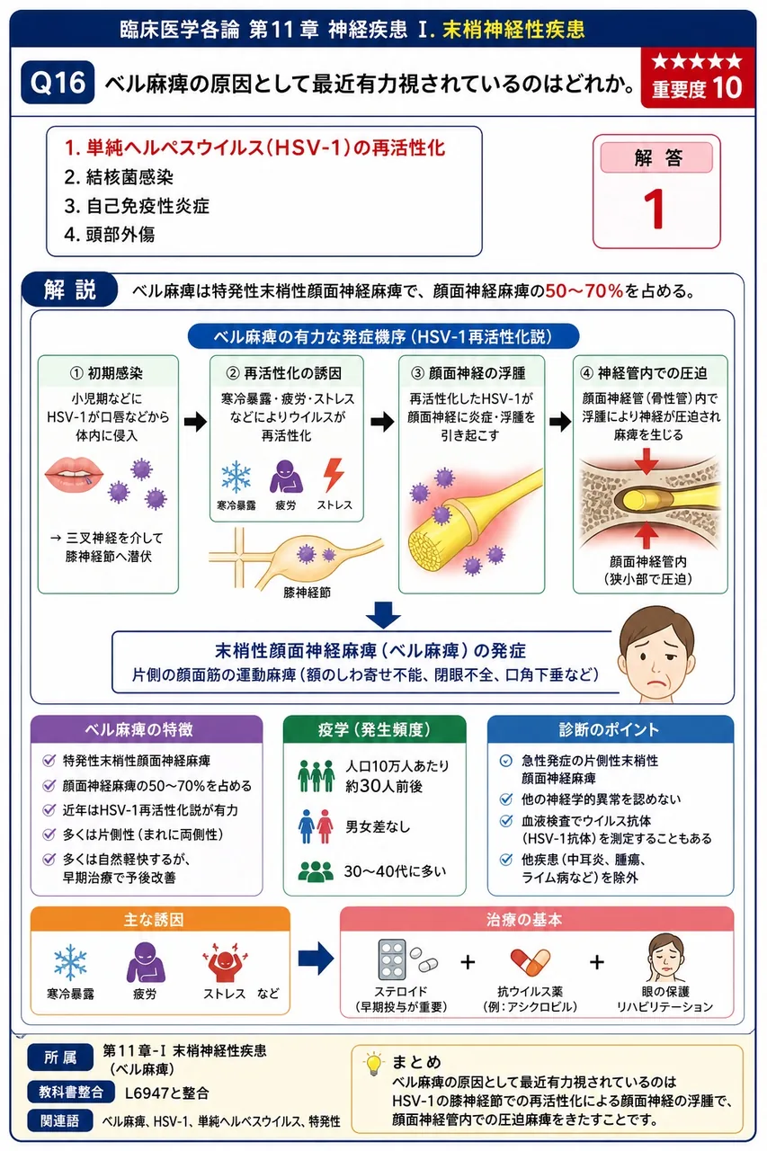 ベル麻痺の原因として最近有力視されているのはどれか。 解説図