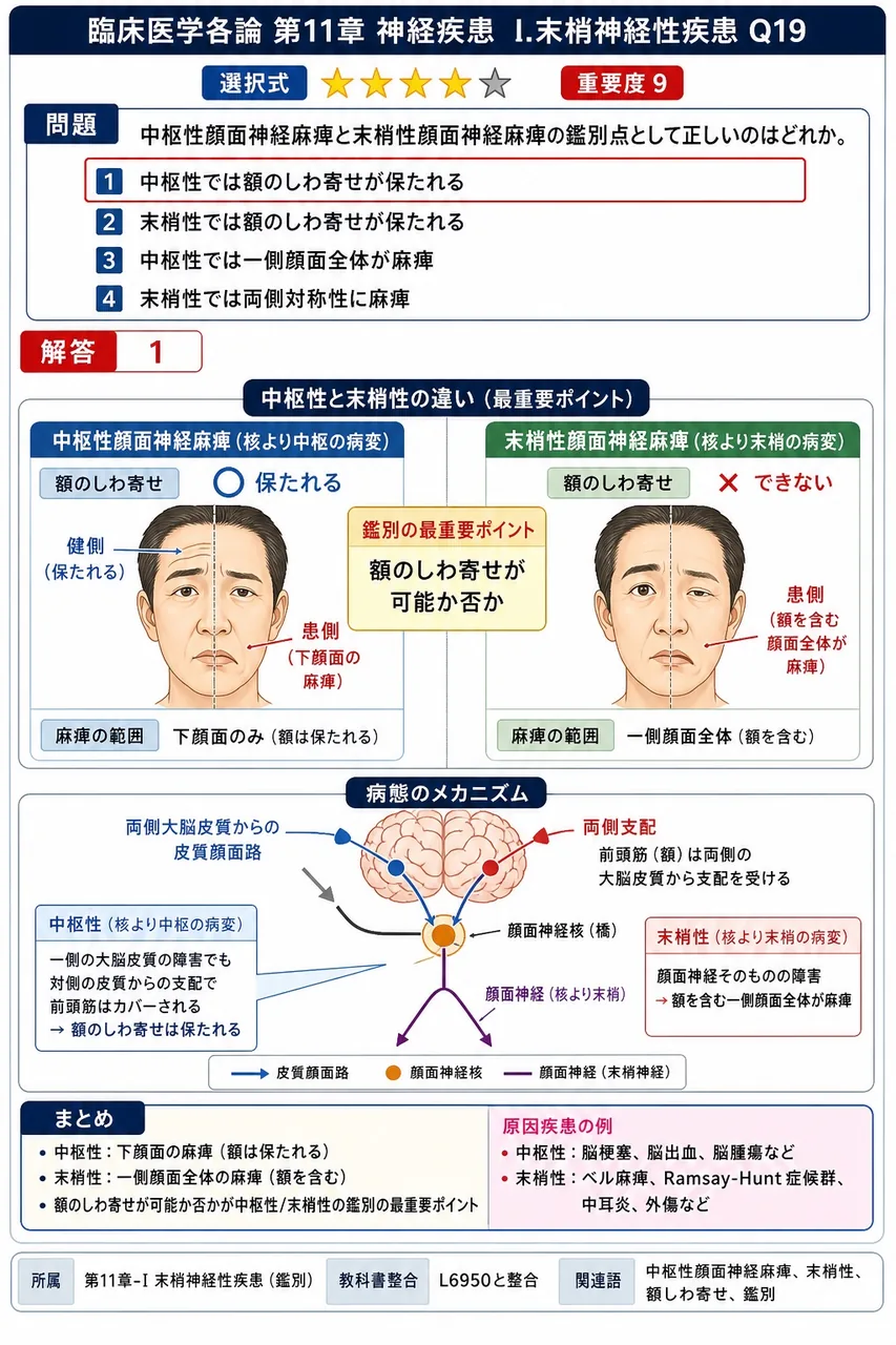 中枢性顔面神経麻痺と末梢性顔面神経麻痺の鑑別点として正しいのはどれか。 解説図