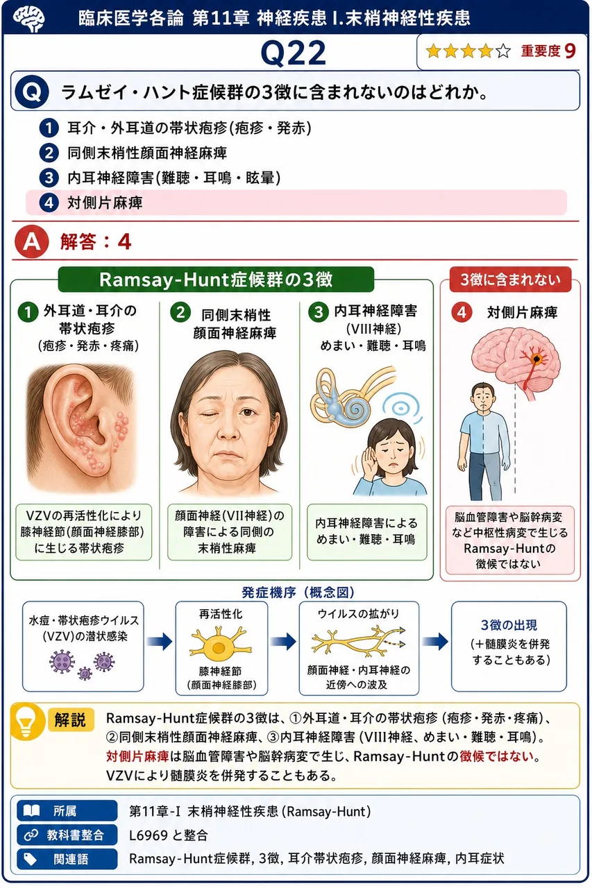 ラムゼイ・ハント症候群の3徴に含まれないのはどれか。 解説図