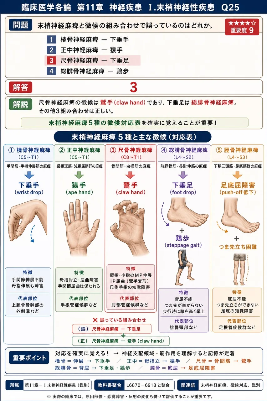末梢神経麻痺と徴候の組み合わせで誤っているのはどれか。 解説図
