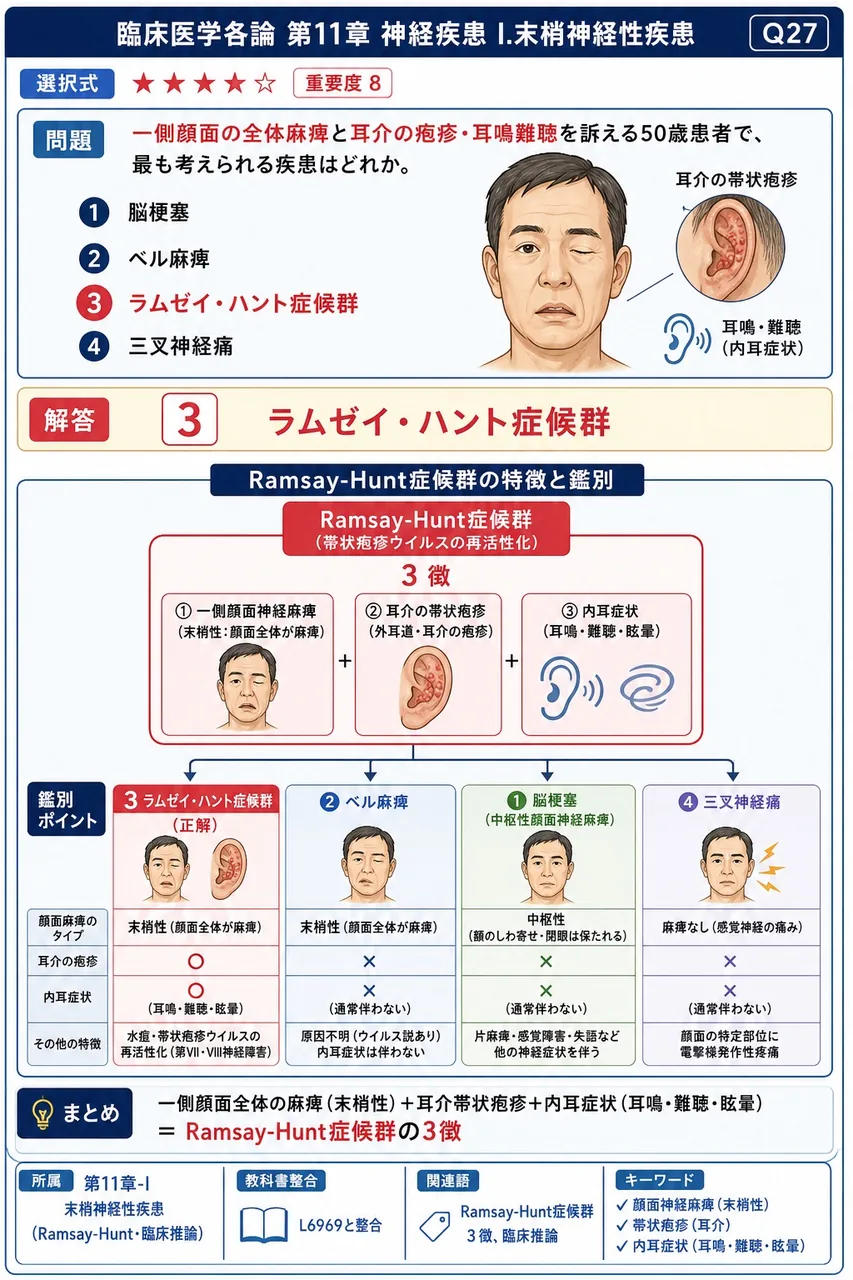 一側顔面の全体麻痺と耳介の疱疹・耳鳴難聴を訴える50歳患者で、最も考えられる疾患はどれか。 解説図