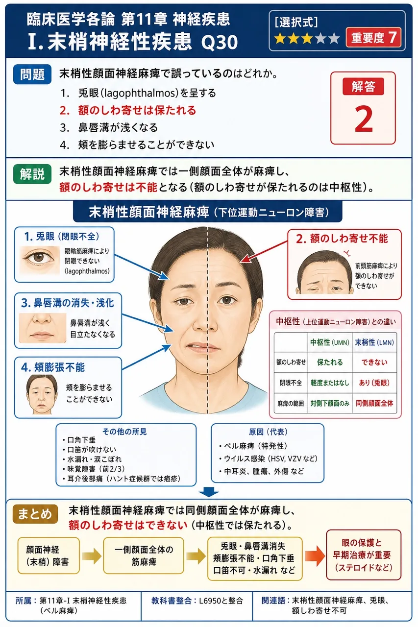 末梢性顔面神経麻痺で誤っているのはどれか。 解説図