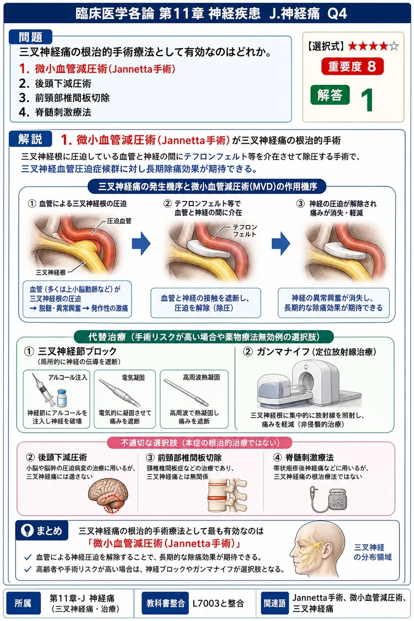 三叉神経痛の根治的手術療法として有効なのはどれか。 解説図