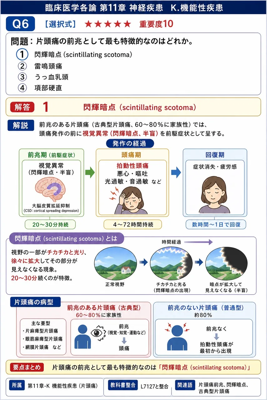 片頭痛の前兆として最も特徴的なのはどれか。 解説図