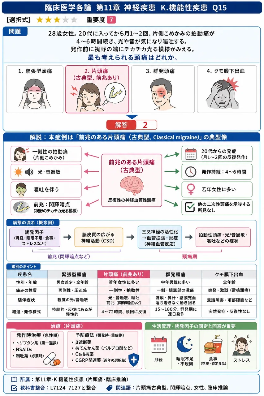 「28歳女性。20代に入ってから月1〜2回、片側こめかみの拍動痛が4〜6時間続き、光や音が気になり嘔吐する。発作前に視野の端にチカチカ光る模様がみえる。」最も考えられる頭痛はどれか。 解説図