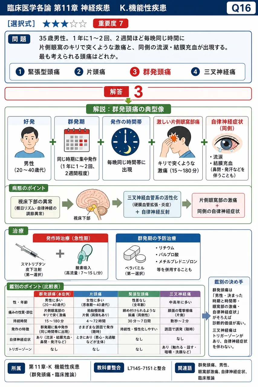 「35歳男性。1年に1〜2回、2週間ほど毎晩同じ時間に片側眼窩のキリで突くような激痛と、同側の流涙・結膜充血が出現する。」最も考えられる頭痛はどれか。 解説図