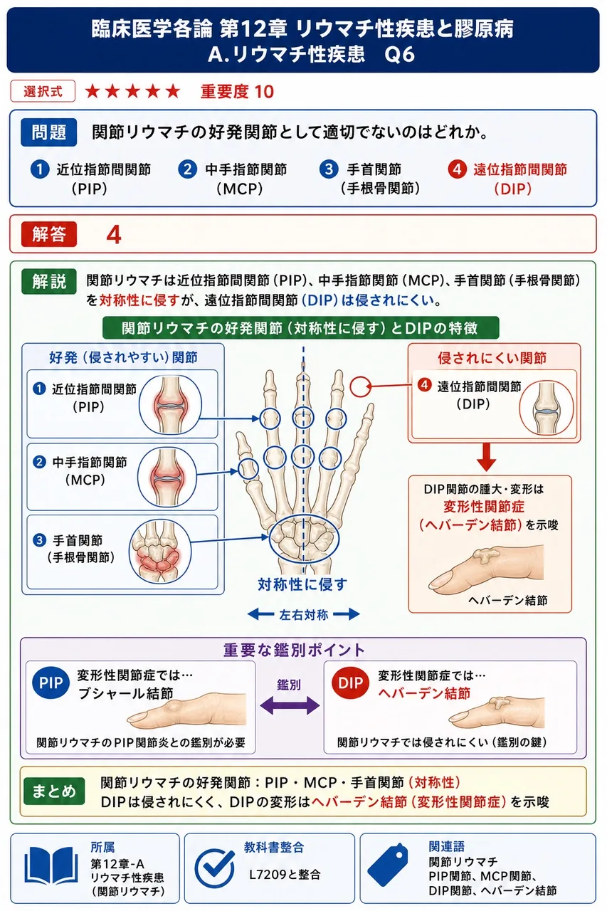 関節リウマチの好発関節として適切でないのはどれか。 解説図