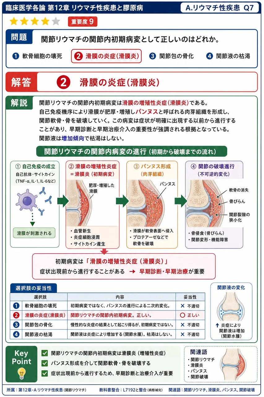 関節リウマチの関節内初期病変として正しいのはどれか。 解説図