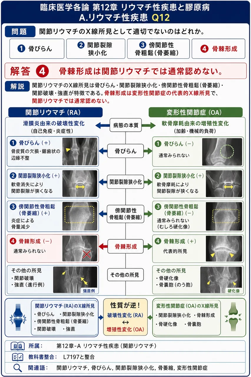 関節リウマチのX線所見として適切でないのはどれか。 解説図