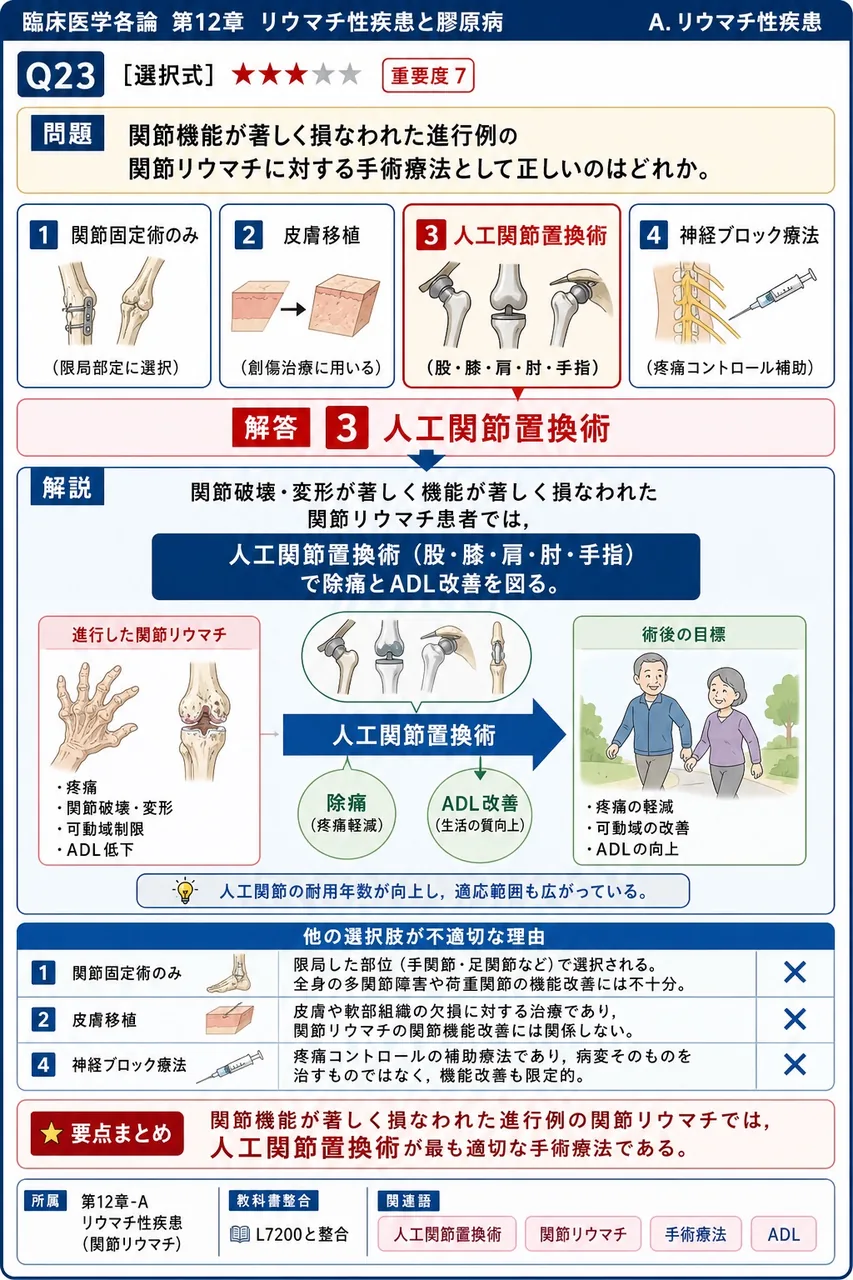 関節機能が著しく損なわれた進行例の関節リウマチに対する手術療法として正しいのはどれか。 解説図