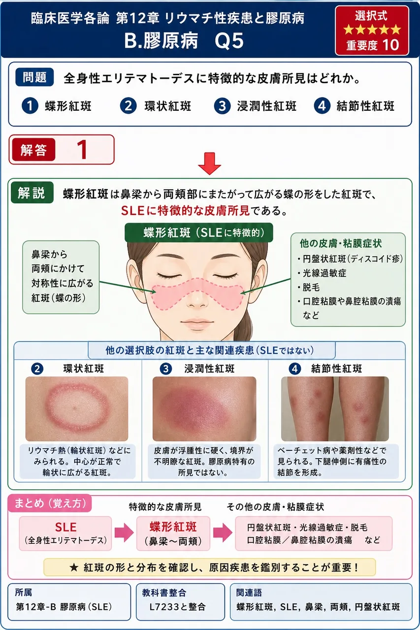 全身性エリテマトーデスに特徴的な皮膚所見はどれか。 解説図