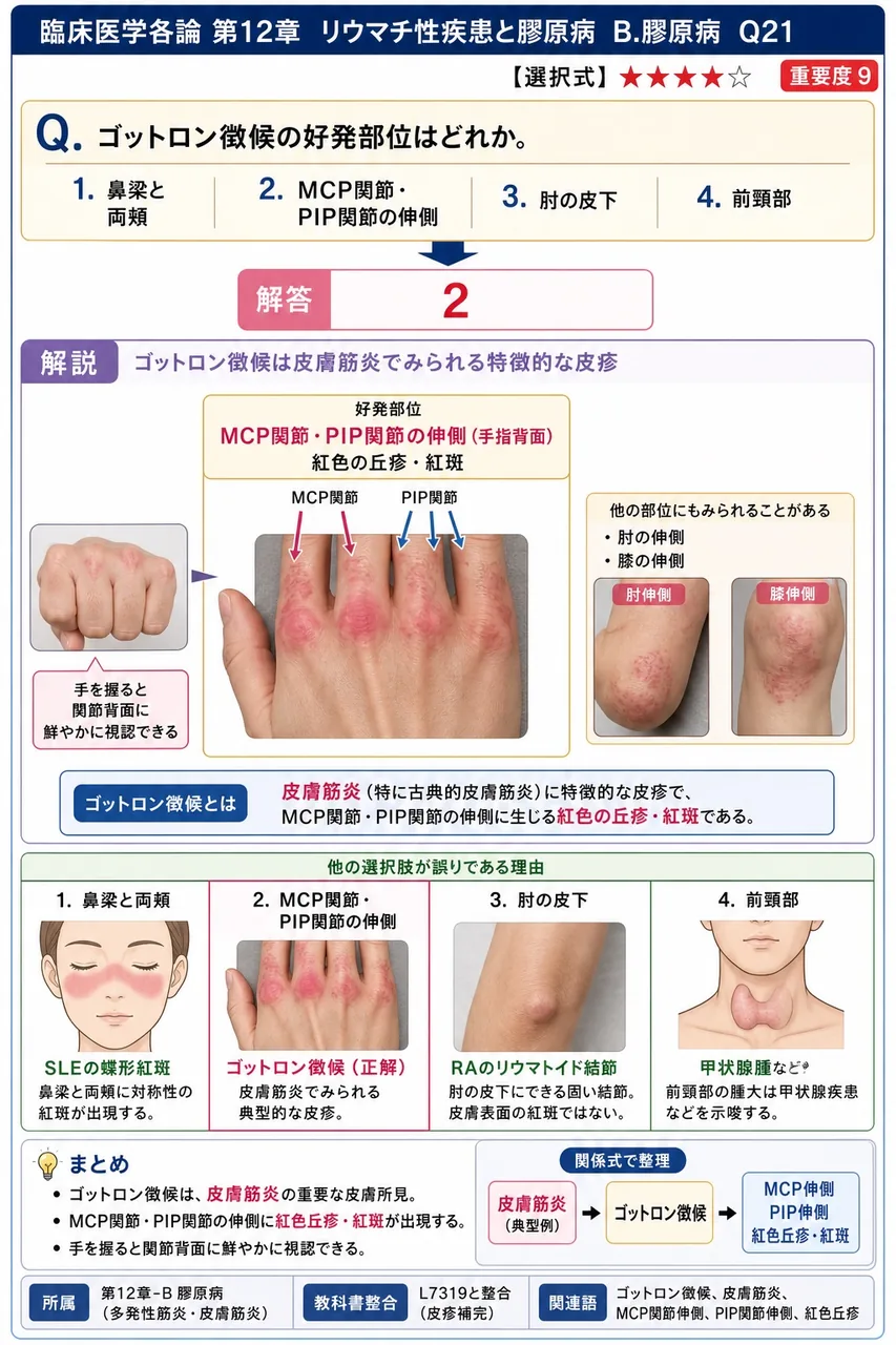 ゴットロン徴候の好発部位はどれか。 解説図