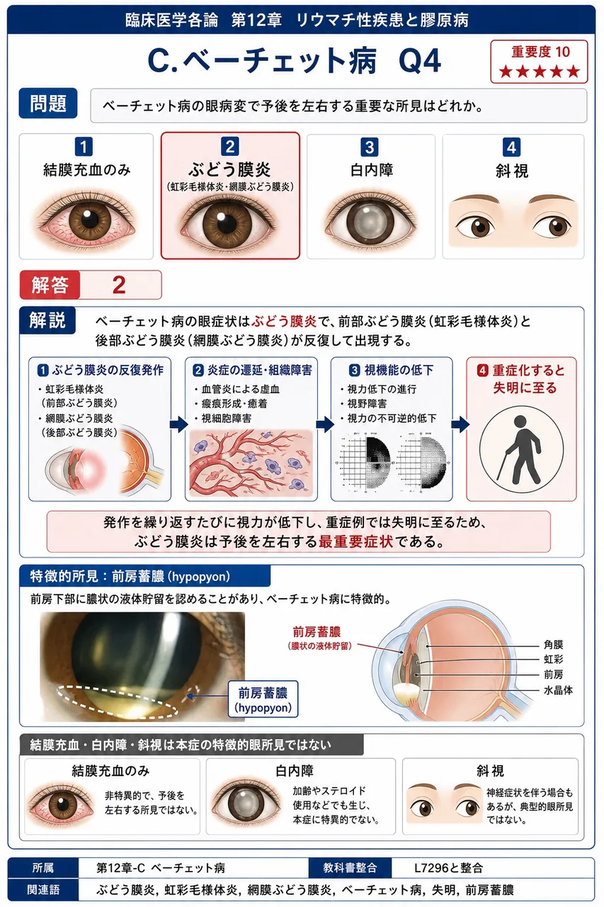 ベーチェット病の眼病変で予後を左右する重要な所見はどれか。 解説図