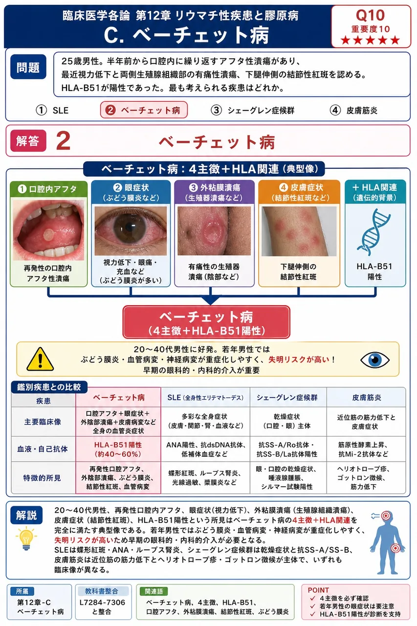 25歳男性。半年前から口腔内に繰り返すアフタ性潰瘍があり、最近視力低下と両側陰嚢部の有痛性潰瘍、下腿伸側の結節性紅斑を認める。HLA-B51が陽性であった。最も考えられる疾患はどれか。 解説図